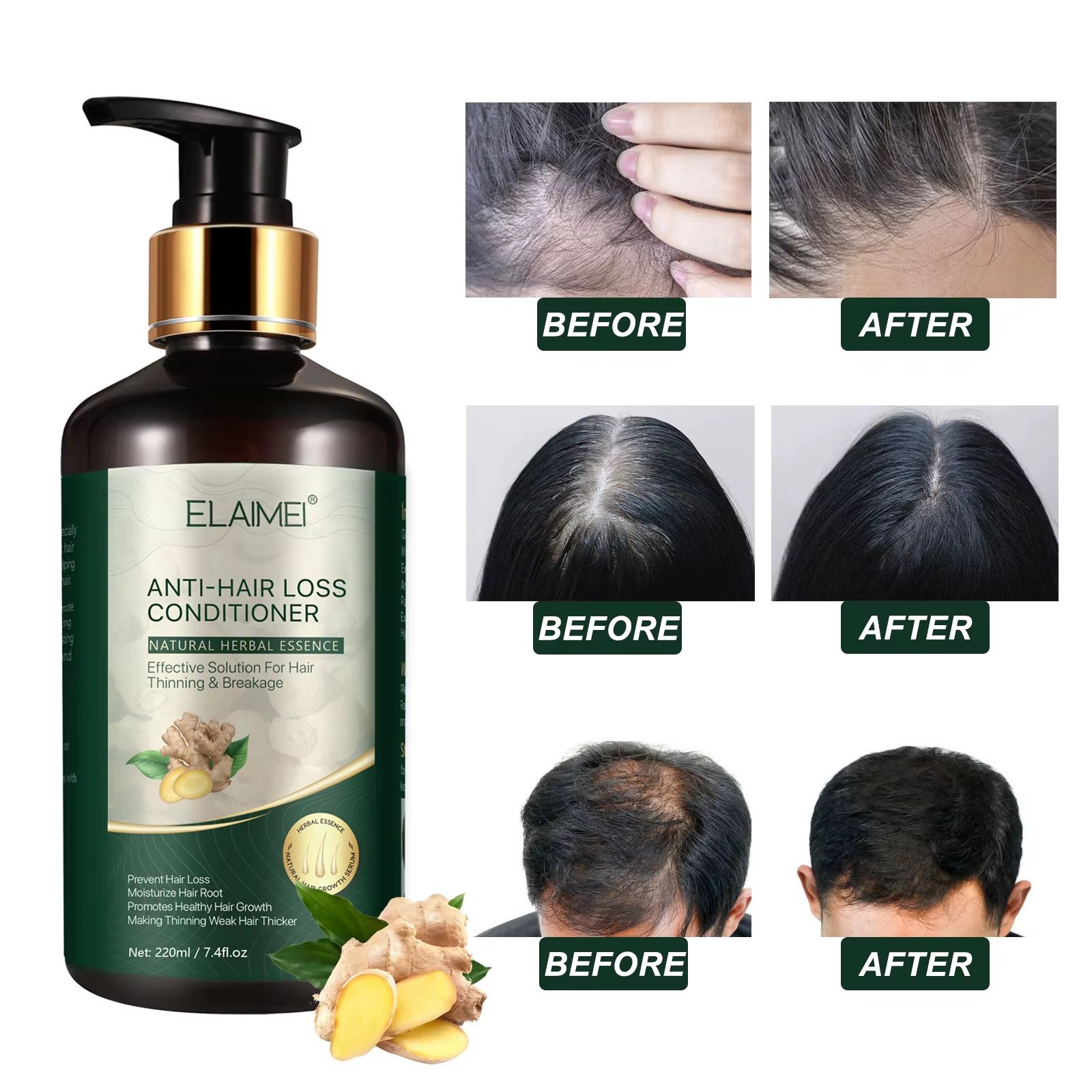 Anti-Hair Loss Conditioner - Effective Solution For Hair Thinning & Breakage - Image 2